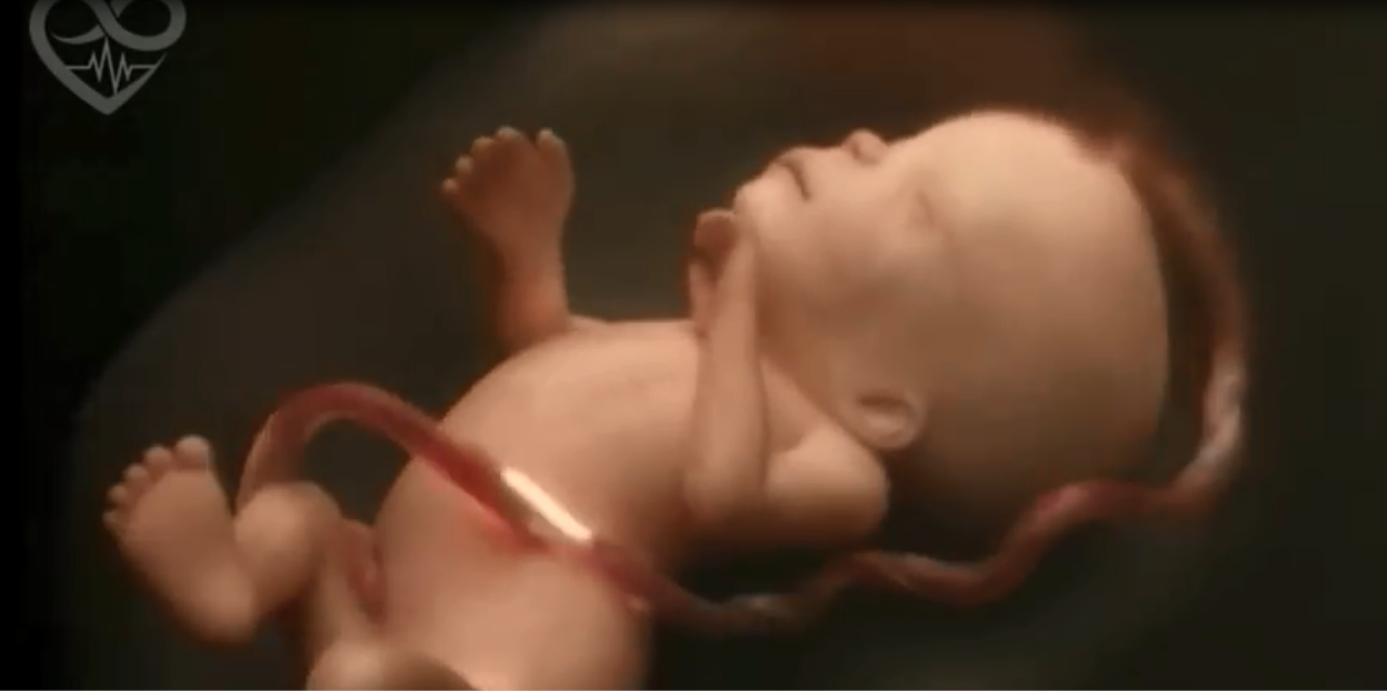 Видео 20 недель. Малыш в утробе матери. Пуповина у ребенка в утробе. Обвития ребенка в утробе.